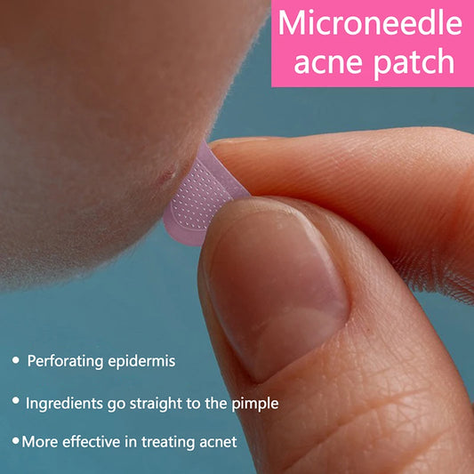 Salicylic Acid Microneedle Acne Patches — Water-Soluble Blemish Treatment Stickers